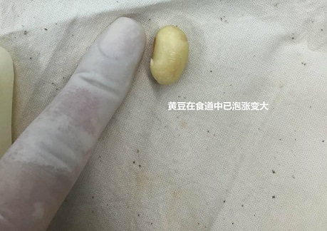 毛豆和手指的对比.JPG